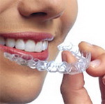 ORTHO SNAP, INVISALIGN