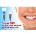 Акция – на второй зубной имплантат скидка 50%